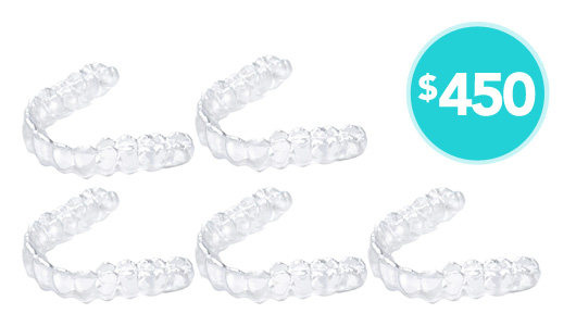 5aligners