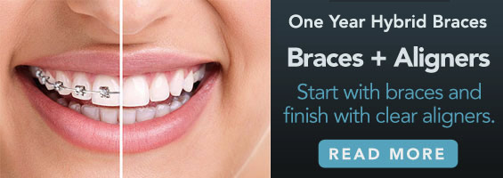 Start with braces and finish with clear aligners.