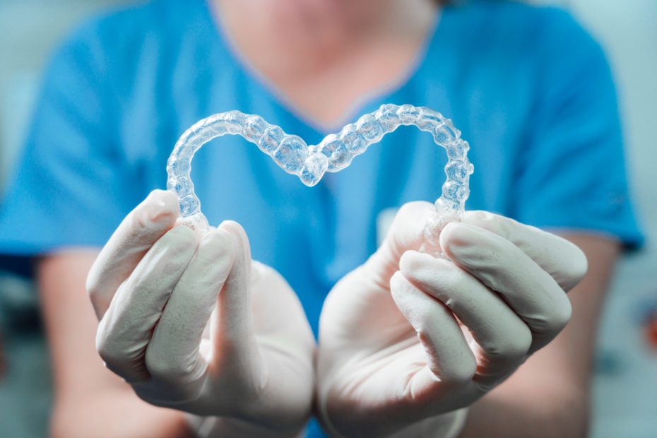 clear aligners